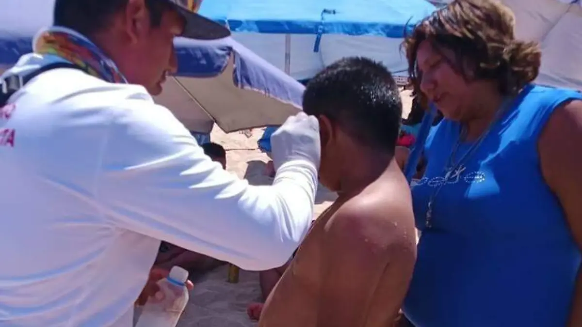 Aguamalas en playas de Los Cabos
